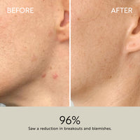 Clarity Purifying Oil-Serum