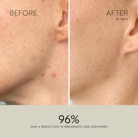 Clarity Purifying Oil-Serum