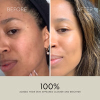 Clarity Purifying Oil-Serum