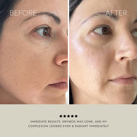 Clarity Purifying Oil-Serum