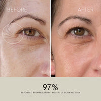 Collagen Boosting Oil-Serum