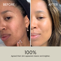 Clarity Purifying Oil-Serum