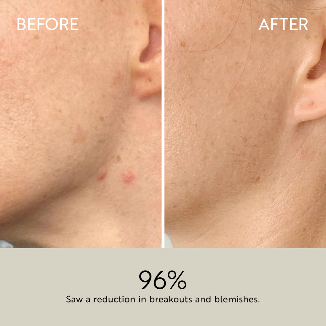 Clarity Purifying Oil-Serum