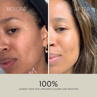 Clarity Purifying Oil-Serum