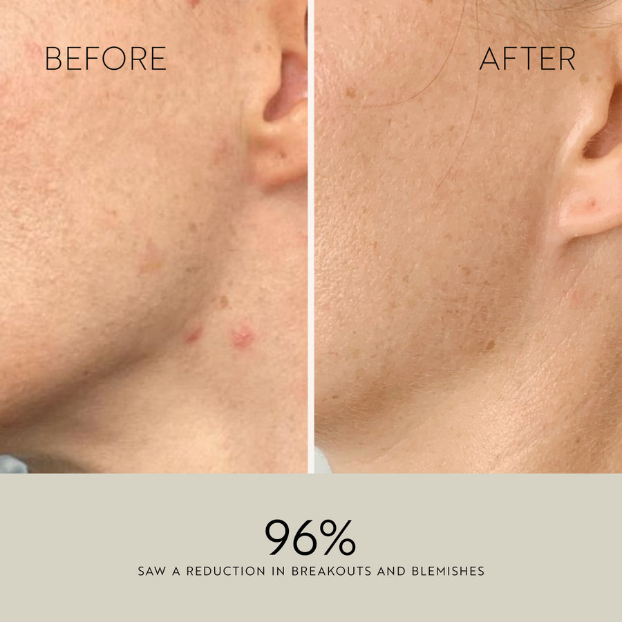 Clarity Purifying Oil-Serum