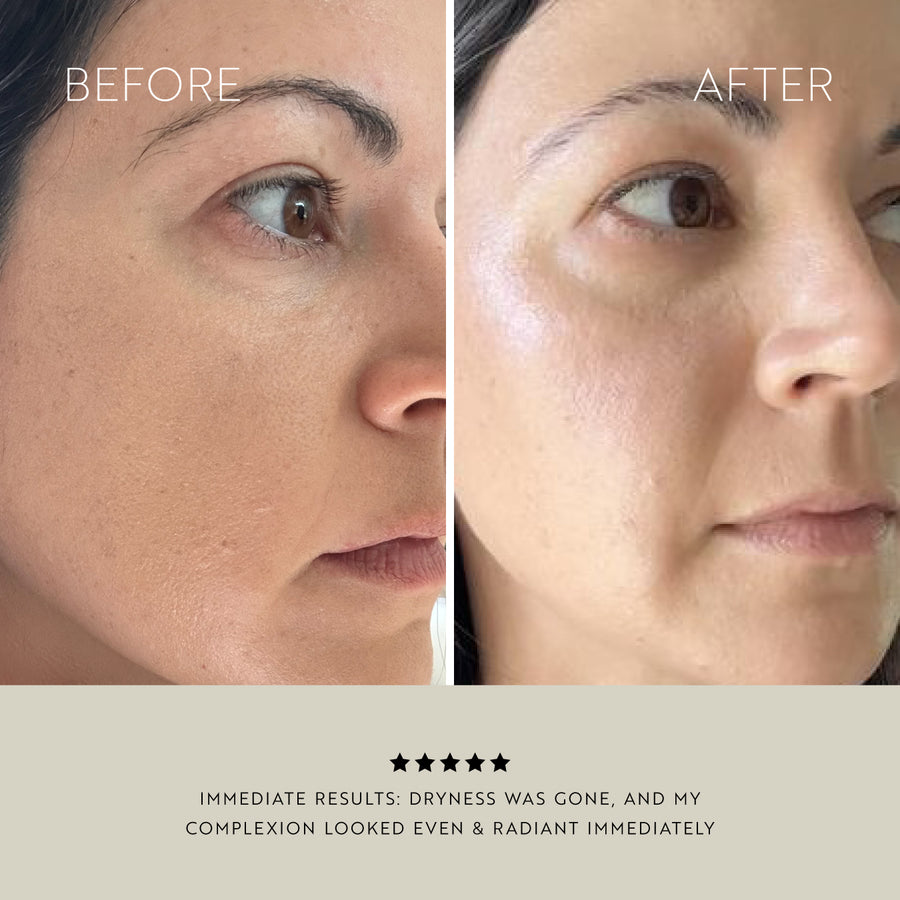 Clarity Purifying Oil-Serum