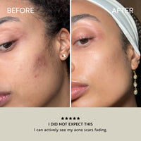 Clarity Purifying Oil-Serum