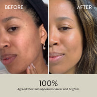 Clarity Purifying Oil-Serum